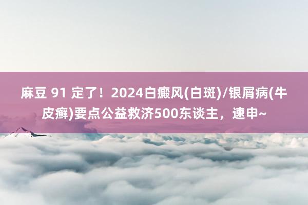 麻豆 91 定了！2024白癜风(白斑)/银屑病(牛皮癣)要点公益救济500东谈主，速申~